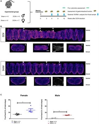 Degenerative Cervical Myelopathy induces sex-specific dysbiosis in mice